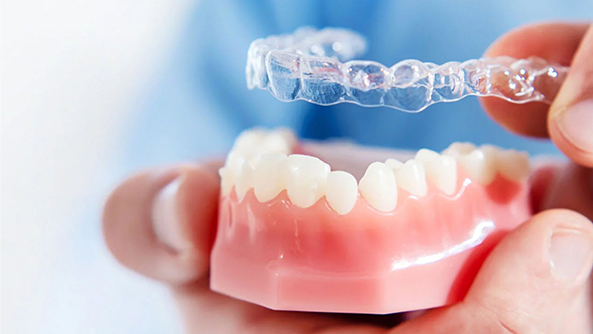 invisalign-tedavisi-4