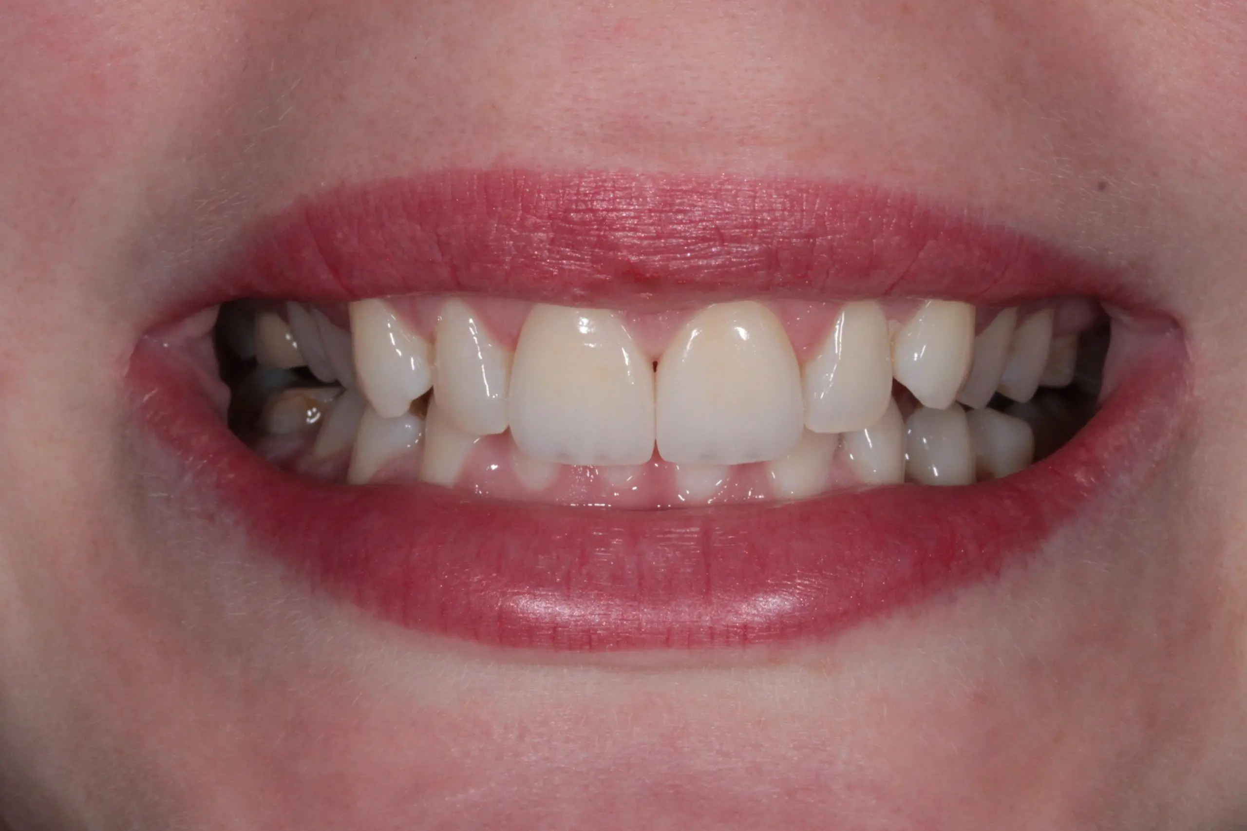 Smile Aesthetics