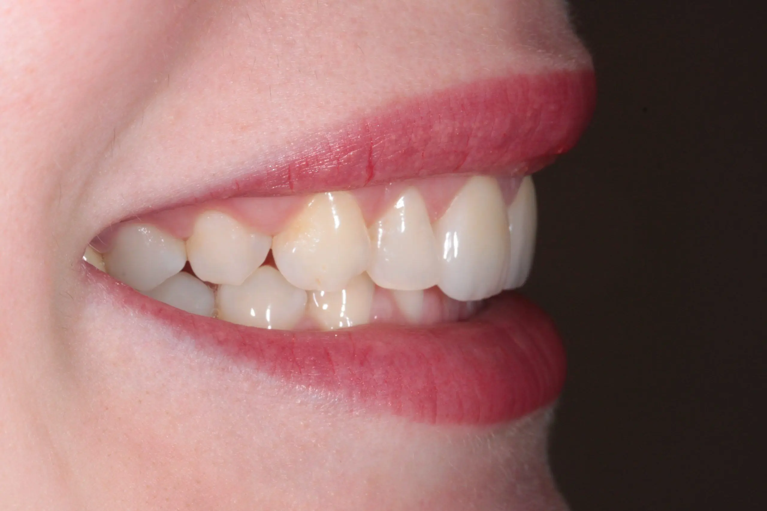 Smile Aesthetics