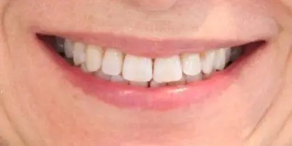 Smile Aesthetics