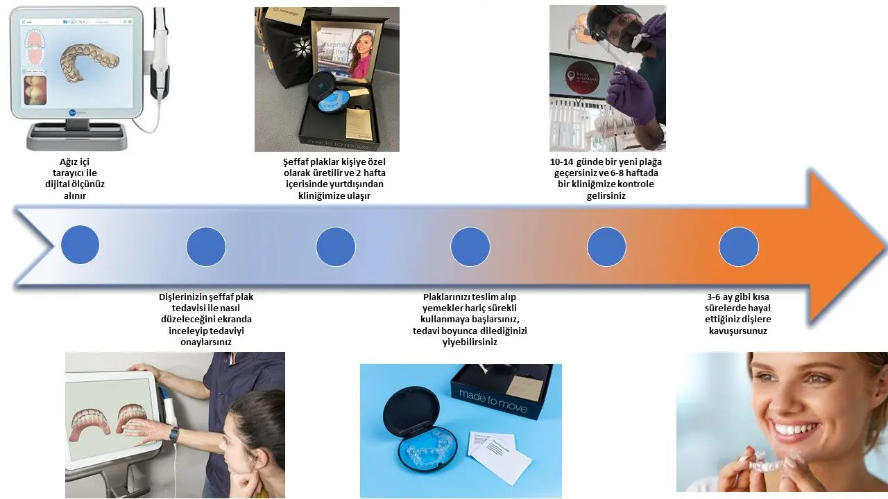 İnvisalign Süreç