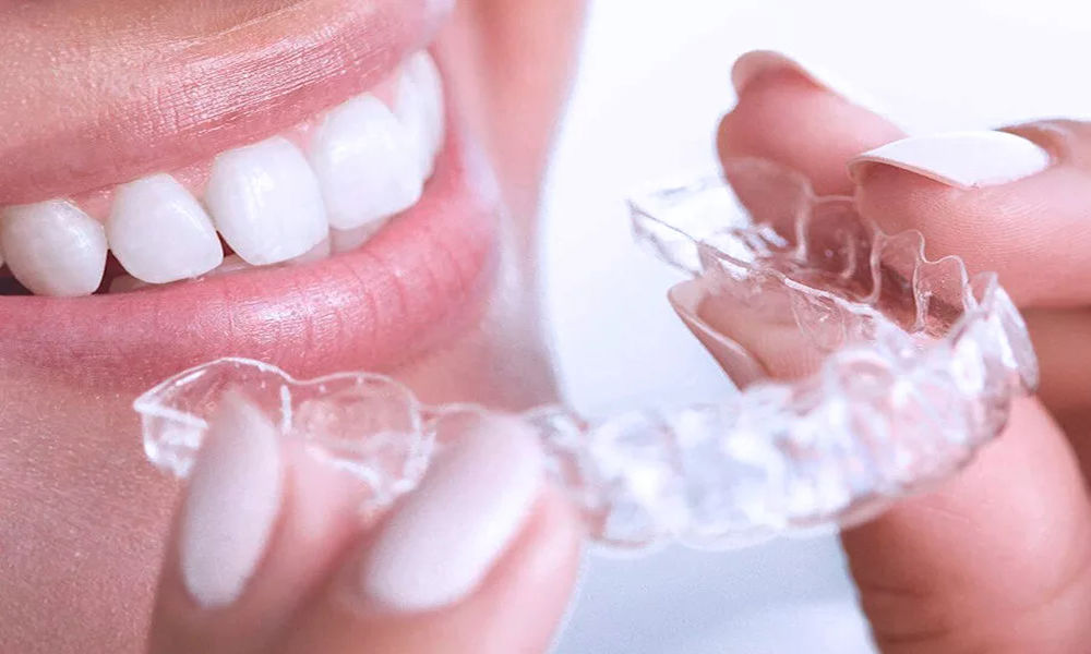 İnvisalign Tedavisi Ne Kadar Sürer?